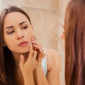 PARAR DE TOMAR PÍLULA ANTICONCEPCIONAL PODE TRAZER AS ESPINHAS DE VOLTA?
