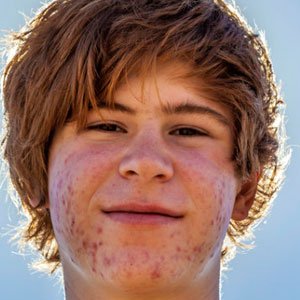 ACNE E SOL: COMO SE PROTEGER DA MELHOR MANEIRA E CUIDAR DA PELE? - Site Cuidados pela Vida