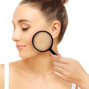 VOCÊ SABE O QUE É MELASMA? ENTENDA AS CAUSAS, SINTOMAS E TRATAMENTOS PARA AS MANCHAS NA PELE